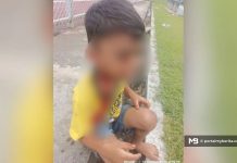Budak 7 tahun parah diserang lapan anjing liar Budak 7 tahun parah diserang lapan anjing liar