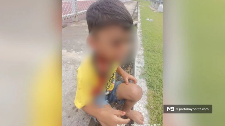 Budak 7 tahun parah diserang lapan anjing liar